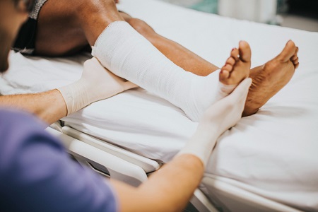 Do Brittle Bones and Hormones Have a Connection?