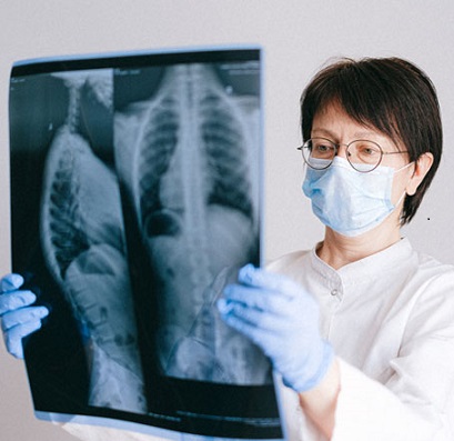 Can Lung Cancer Be Diagnosed Without a Biopsy?