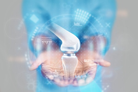When Is Joint Replacement Surgery Necessary?